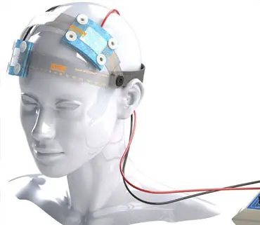 tDCS-Transcranial Direct Current Stimulation, The Sleep Centre